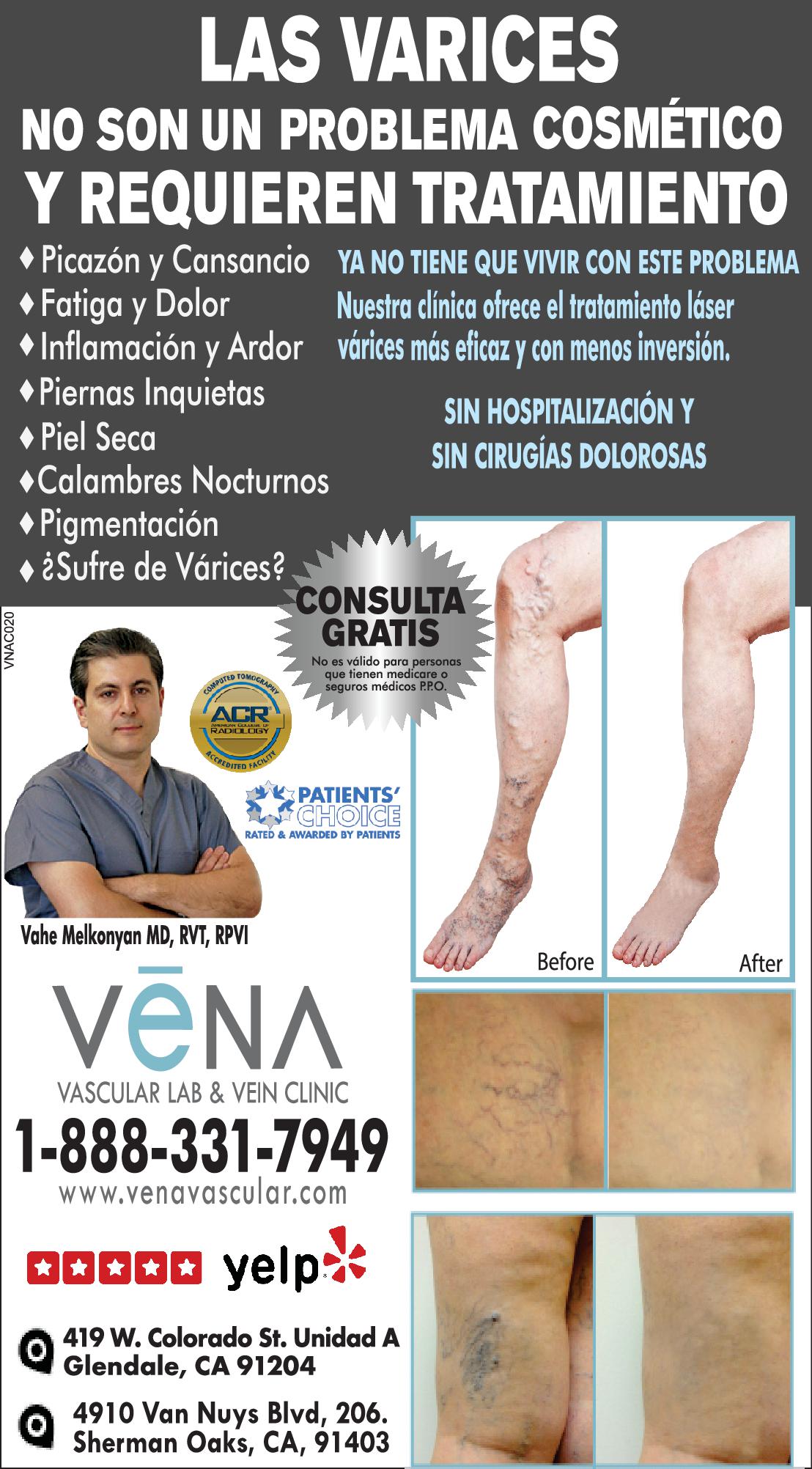 Vena Vascular Lab & Vein Clinic