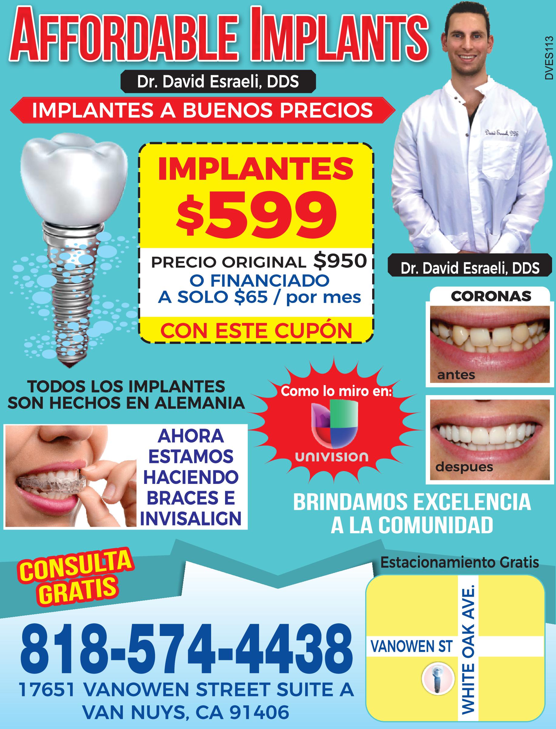 Affordable Implants-implantes A Buenos Precios-david Esraeli Dds