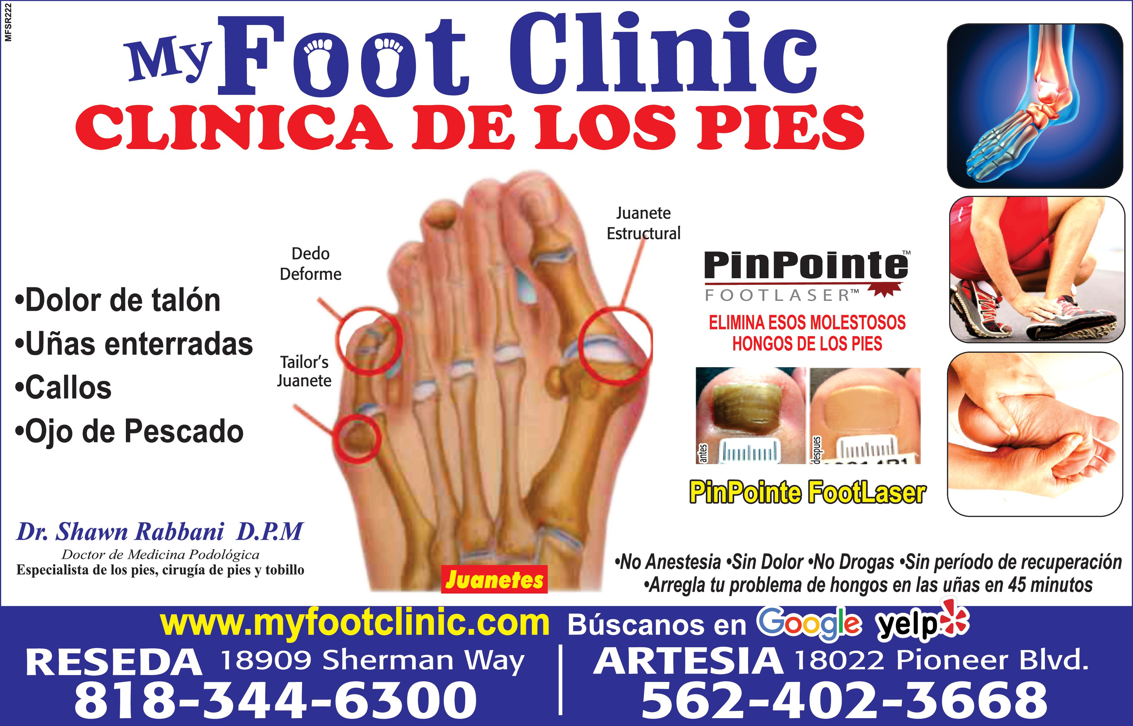 MFT1222 My Foot Clinic CLINICA DE LOS PIES Dolor de talón Dedo Deforme Uñas enterradas Callos Ojo de Pescado Tailor
