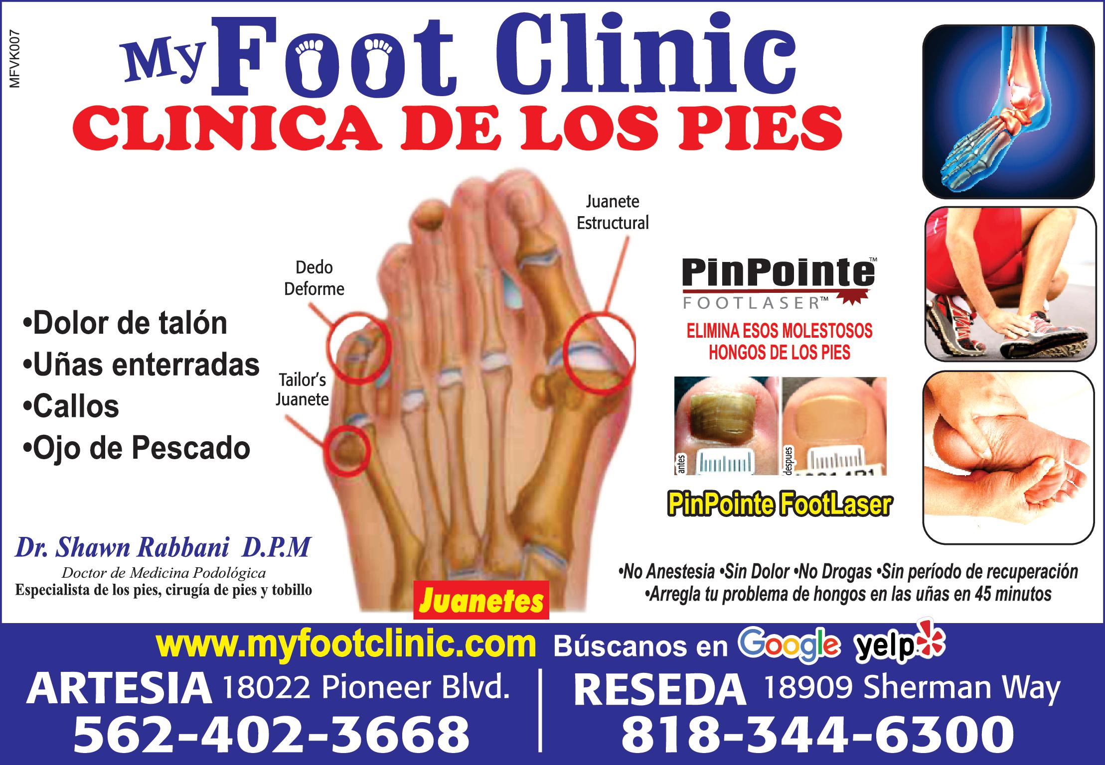 MFVK007 My Foot Clinic CLINICA DE LOS PIES Dolor de talón Dedo Deforme Uñas enterradas Callos Ojo de Pescado Tailor