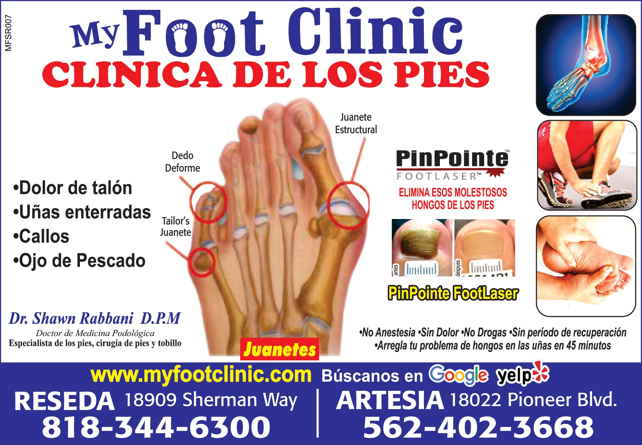 MFSR007 My Foot Clinic CLINICA DE LOS PIES Dolor de talón Dedo Deforme Uñas enterradas Callos Ojo de Pescado Tailor