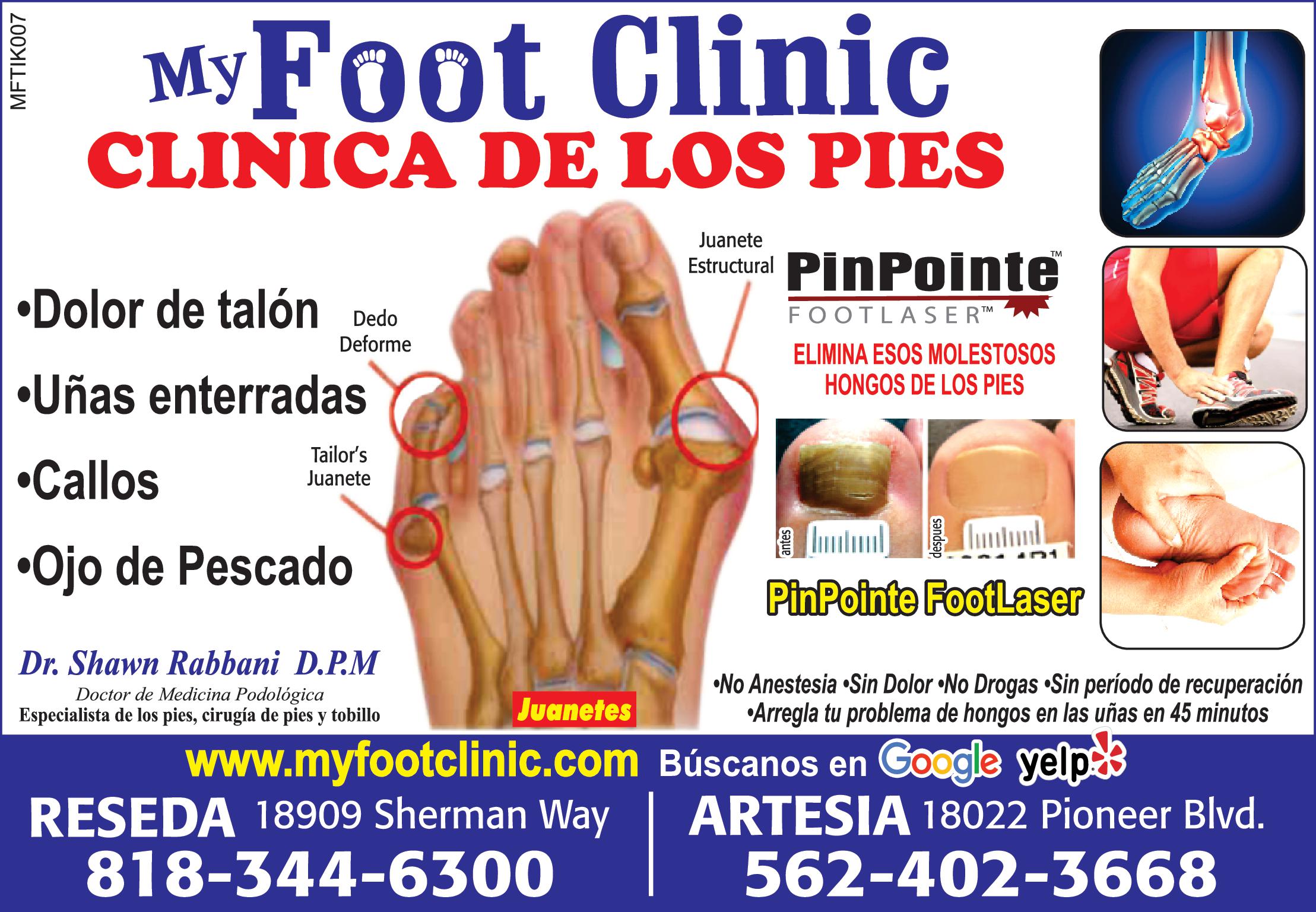 MFTIK007 My Foot Clinic CLINICA DE LOS PIES Dolor de talón Dedo Deforme Uñas enterradas Callos Ojo de Pescado Tailor