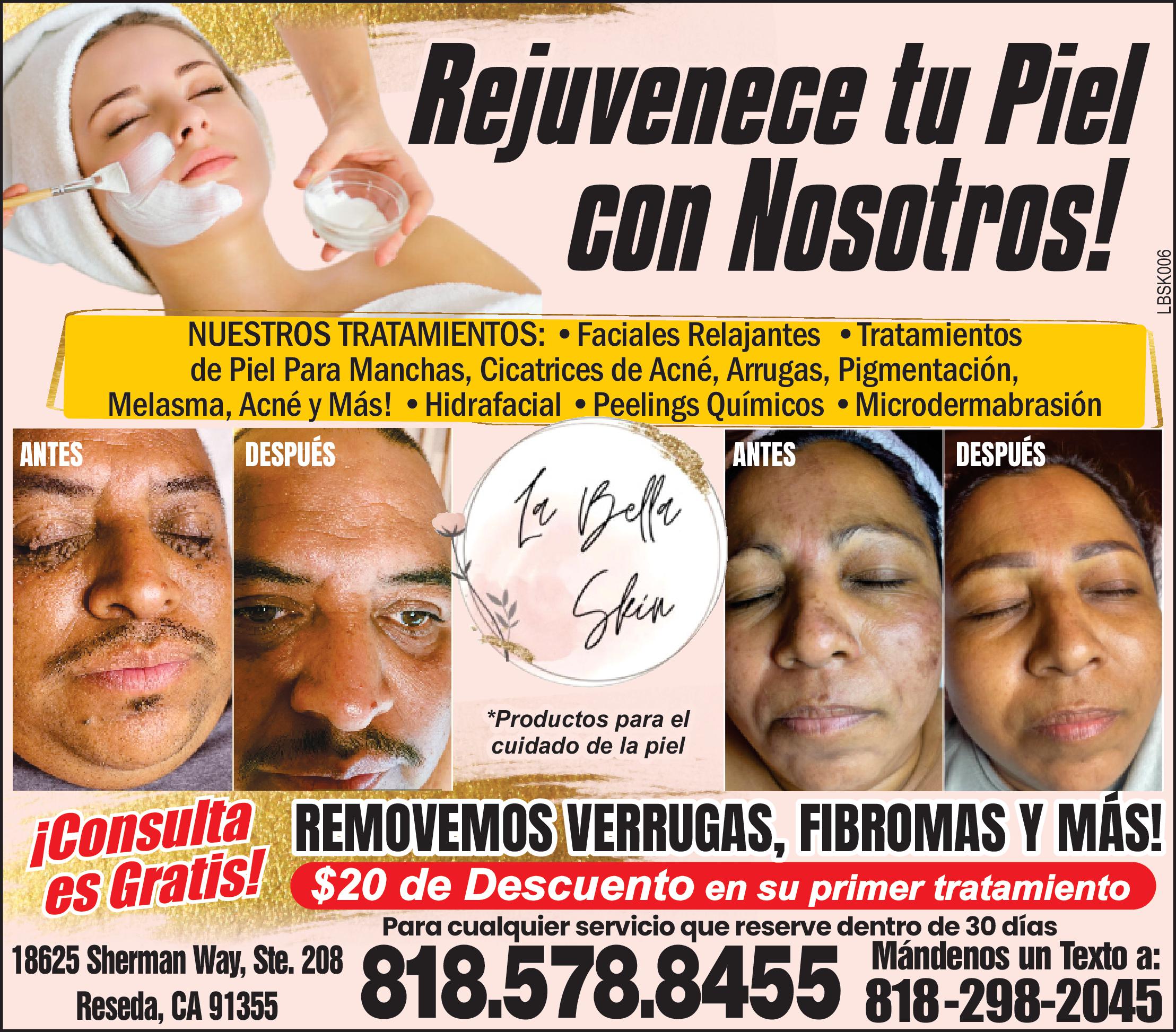 La Bella Skin
Rejuvenece tu Piel con nosotros!
Nuestros Tratamientos:
Faciales Relajantes
Tratamientos de Piel para Manchas
Cicatrices de Acné
Arrugas
Pigmentación
Melasma
Acné y Más!
Hidrafacial
Peelings Químicos
Microdermabrasión
Revomemos Verrugas, Fibromas y más!
Consulta es Gratis!
$ 20 de Descuento en su primer tratamiento
Hablamos Español
(818) 578-8455
Mándenos un Texto a:
(818) 298-2045
Productos para el cuidado de la piel